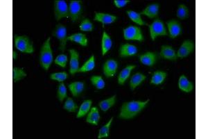 Immunofluorescence staining of A549 cells with ABIN7146089 at 1:166, counter-stained with DAPI.