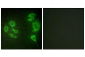 Immunofluorescence (IF) image for anti-Mitogen-Activated Protein Kinase Kinase Kinase MLT (ZAK) (C-Term) antibody (ABIN1850019) (ZAK antibody  (C-Term))