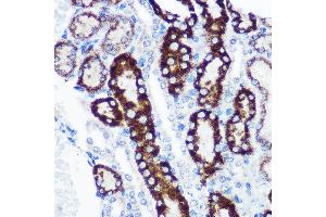 Immunohistochemistry of paraffin-embedded Mouse kidney using FCHSD1 Rabbit pAb (ABIN7270317) at dilution of 1:100 (40x lens). (FCHSD1 antibody  (AA 100-400))