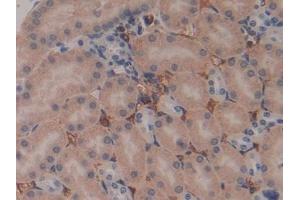 Immunohistochemistry (IHC) image for anti-Pregnancy Zone Protein (PZP) (AA 1224-1495) antibody (ABIN7438847)