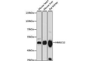 Western blot analysis of extracts of various cell lines, using HMGCS2 antibody (ABIN7265329) at 1:1000 dilution. (HMGCS2 antibody  (AA 269-508))