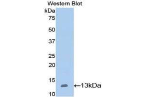 Detection of Recombinant NPHN, Mouse using Polyclonal Antibody to Nephrin (NPHN) (Nephrin antibody  (AA 39-144))