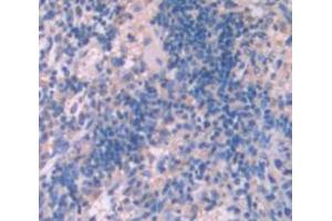 Figure. (Aryl Hydrocarbon Receptor antibody  (AA 311-579))