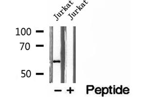 Western blot analysis of extracts of Jurkat cells, using PHGDH antibody.