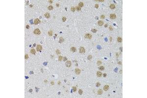 Immunohistochemistry of paraffin-embedded mouse brain using DMAP1 antibody (ABIN4903487) at dilution of 1:100 (40x lens).
