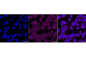 Immunocytochemical staining of HepG2 cells with RAD21 antibody (ABIN7800115), 1:1,000).