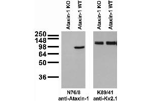 Adult rat brain immunoblot: extracts of cerebella from Ataxin-1 KO and WT mice and probed with N76/8 (left) or K89/41 (right) TC supe.