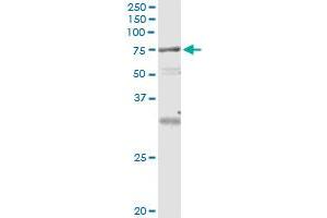 Immunoprecipitation of VPS18 transfected lysate using anti-VPS18 monoclonal antibody and Protein A Magnetic Bead , and immunoblotted with VPS18 MaxPab rabbit polyclonal antibody. (VPS18 antibody  (AA 3-100))