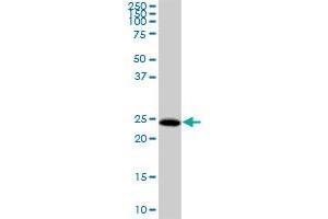 HDHD3 MaxPab polyclonal antibody. (HDHD3 antibody  (AA 1-251))