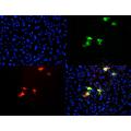 anti-mCherry Fluorescent Protein antibody