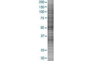 C3orf64 transfected lysate. (C3orf64 293T Cell Transient Overexpression Lysate(Denatured))