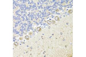 Immunohistochemistry of paraffin-embedded rat cerebellum using TrkA Antibody (ABIN3022908, ABIN3022909, ABIN3022910 and ABIN6219291) at dilution of 1:100 (40x lens). (TRKA antibody  (AA 1-280))