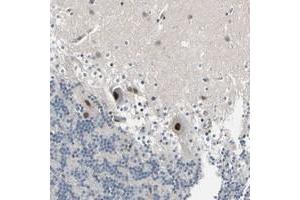 Immunohistochemical staining of human cerebellum with PSMA2 polyclonal antibody  shows strong nuclear positivity in purkinje cells.