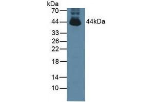 Detection of PTPN2 in Mouse Testis Tissue using Polyclonal Antibody to Protein Tyrosine Phosphatase, Non Receptor Type 2 (PTPN2) (PTPN2 antibody  (AA 1-257))