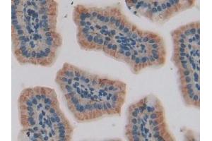 Detection of IGFBP5 in Mouse Small intestine Tissue using Polyclonal Antibody to Insulin Like Growth Factor Binding Protein 5 (IGFBP5) (IGFBP5 antibody  (AA 25-271))