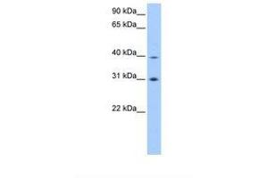 Image no. 1 for anti-Eukaryotic Translation Initiation Factor 3 Subunit H (EIF3H) (AA 246-295) antibody (ABIN6738707) (EIF3H antibody  (AA 246-295))