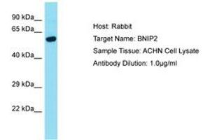 Image no. 1 for anti-BCL2/adenovirus E1B 19kDa Interacting Protein 2 (BNIP2) (AA 152-201) antibody (ABIN6750468) (BNIP2 antibody  (AA 152-201))