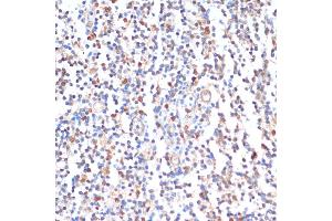 Immunohistochemistry of paraffin-embedded human tonsil using ZMYM3 antibody (ABIN6128940, ABIN6150453, ABIN6150454 and ABIN6216809) at dilution of 1:100 (40x lens).