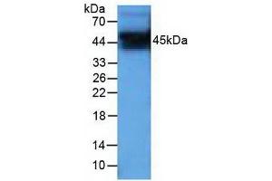 Detection of PIM1 in Human PC-3 cells using Polyclonal Antibody to Pim-1 Oncogene (PIM1) (PIM1 antibody  (AA 129-268))