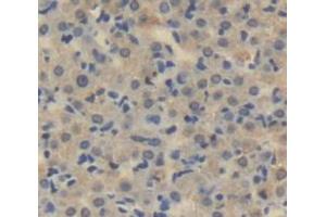 IHC-P analysis of Human Tissue, with DAB staining. (LOXL3 antibody  (AA 519-726))