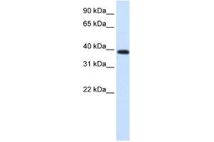 WB Suggested Anti-PTDSR Antibody Titration: 0.