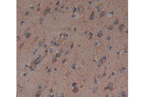 Used in DAB staining on fromalin fixed paraffin- embedded brain tissue (Dynamin 3 antibody  (AA 1-323))