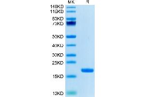 Biotinylated Human IL-18 on Tris-Bis PAGE under reduced condition. (IL-18 Protein (AA 37-193) (Biotin))