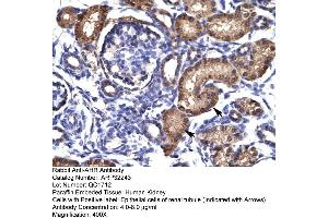 Human kidney (Aryl Hydrocarbon Receptor antibody  (N-Term))