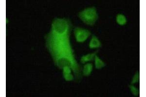 Figure:FITC staining on IHC-P Simple: Hela cells (FLNB antibody  (AA 2061-2193))