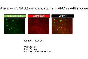 Sample Type: P48 MouseDilution: 1:2000 (KCNAB2 antibody  (Middle Region))