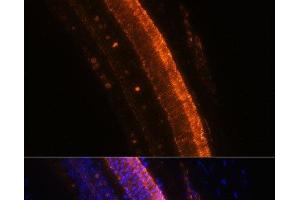 Immunofluorescence analysis of Mouse eye using KCNS2 Polyclonal Antibody at dilution of 1:100 (40x lens).