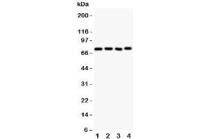 Western blot testing of Tec antbody; Lane 1: rat liver;  2: (r) spleen;  3: (r) kidney;  4: human HeLa;  5: (h) Jurkat cell lysate. (NR4A3 antibody  (AA 612-631))