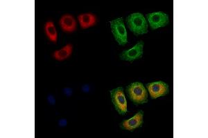 ABIN6256515 and ABIN6267566 staining Hela cells(4h of LPS treatment) by IF/ICC.