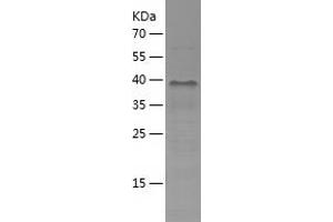 TSSC4 Protein (AA 1-265) (His tag)
