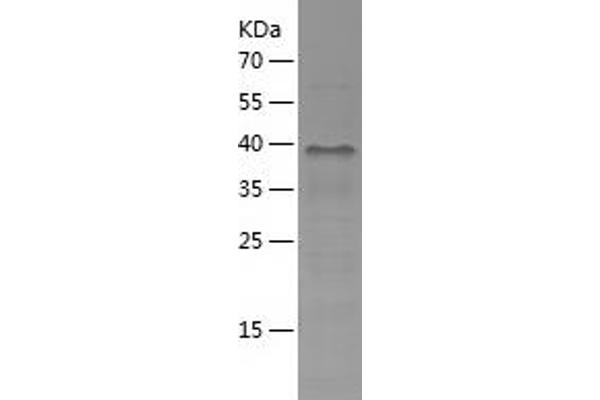 TSSC4 Protein (AA 1-265) (His tag)