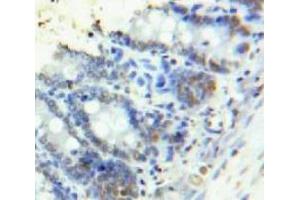 Used in DAB staining on fromalin fixed paraffin-embedded Bowels tissue (HMGA1 antibody  (AA 1-107))