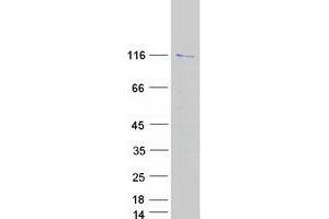 Validation with Western Blot (BOP1 Protein (Myc-DYKDDDDK Tag))