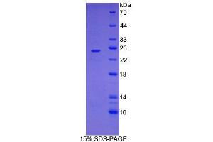 SDS-PAGE analysis of Mouse FOLR4 Protein.
