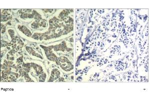 Image no. 1 for anti-Ataxia Telangiectasia and Rad3 Related (ATR) (Ser428) antibody (ABIN319380) (ATR antibody  (Ser428))