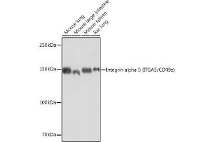 Western blot analysis of extracts of various cell lines, using Integrin alpha 5 (ITG/CD49e) (ITG/CD49e) antibody (ABIN7267936) at 1:1000 dilution.
