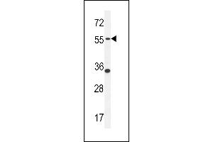 PDE12 Antibody (C-term) (ABIN654246 and ABIN2844072) western blot analysis in MDA-M cell line lysates (35 μg/lane). (PDE12 antibody  (C-Term))