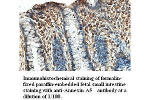 Image no. 1 for anti-Annexin A5 (ANXA5) antibody (ABIN791195) (Annexin V antibody)