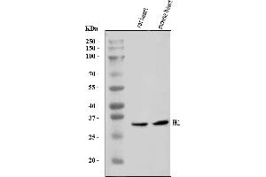 Western blot analysis of FHL1 using anti-FHL1 antibody (ABIN7599973).