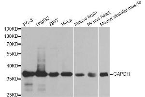 Western blot analysis of extracts of various cell lines, using GAPDH antibody. (GAPDH antibody  (AA 1-335))