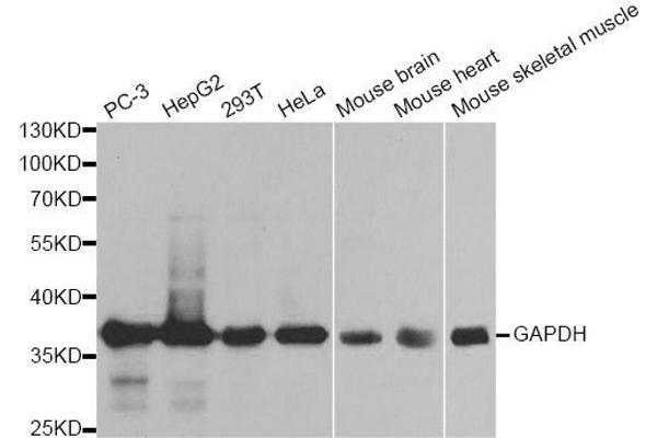 GAPDH 抗体  (AA 1-335)