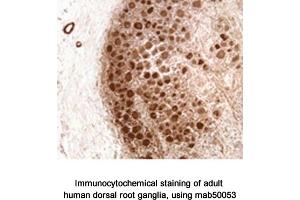 Image no. 1 for anti-Neurofibromin 1 (NF1) (N-Term) antibody (ABIN363207) (Neurofibromin 1 antibody  (N-Term))
