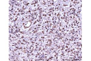 IHC analysis of MEK7/MAP2K7 using anti-MEK7/MAP2K7 antibody (ABIN3043875). (MAP2K7 antibody  (N-Term))