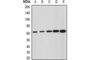 Western blot analysis of GNS expression in SKOV3 (A), Hela (B), mouse liver (C), mouse kidney (D), rat brain (E) whole cell lysates. (GNS antibody)