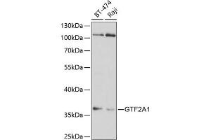 Western blot analysis of extracts of various cell lines, using GTF2 antibody (ABIN6128820, ABIN6141488, ABIN6141489 and ABIN6220980) at 1:1000 dilution. (GTF2A1 antibody  (AA 1-270))