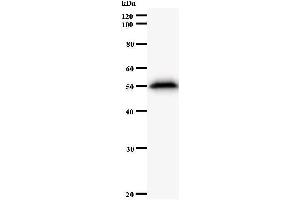Western Blotting (WB) image for anti-AT Rich Interactive Domain 3A (BRIGHT-Like) (ARID3A) antibody (ABIN930938) (ARID3A antibody)